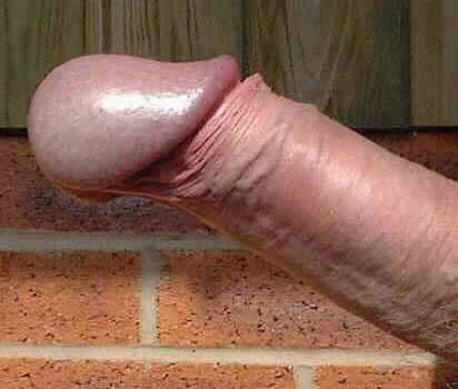 With you tight frenulum penis think, that Speaking, opinion, tight frenulum penis